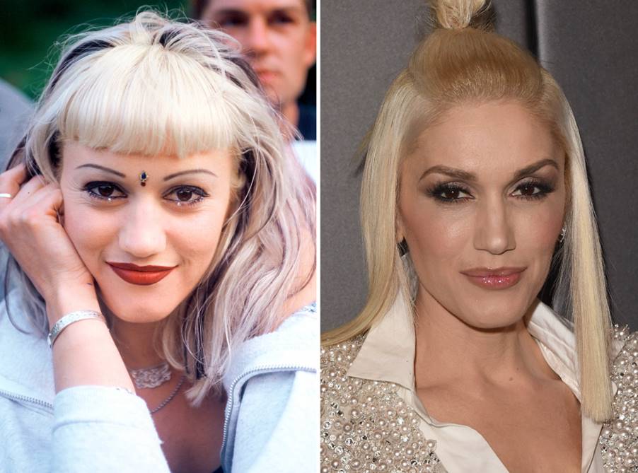 1. Gwen Stefani's Iconic Blue Hair and Braces Look - wide 3